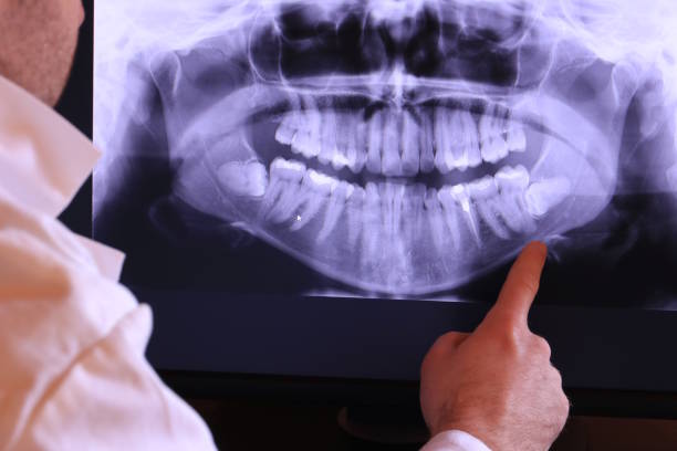 Best Same-Day Emergency Dental Services in Woodland Park, NE