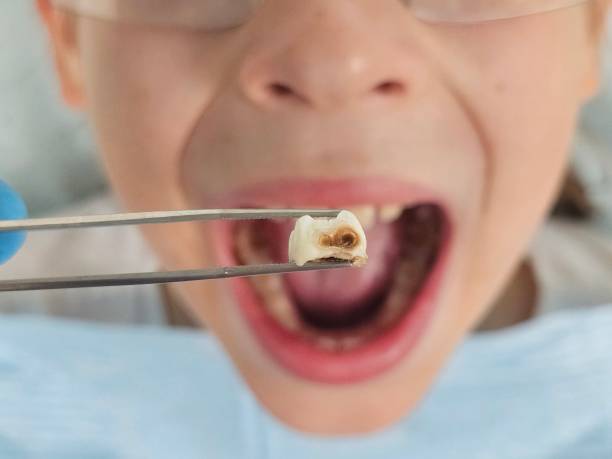 Best Pediatric Emergency Dentist in Woodland Park, NE